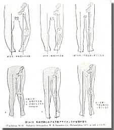 正しい歩き方（足について考える）/子供の足の悩み/扁平足・X脚・うちわ歩き・成長痛etc/京都南カイロプラクティックWebsite